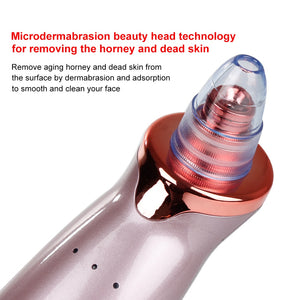 The PoreVac - Blackhead Remover