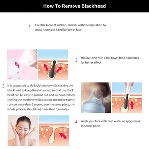 The PoreVac - Blackhead Remover