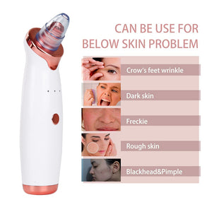 The PoreVac - Blackhead Remover